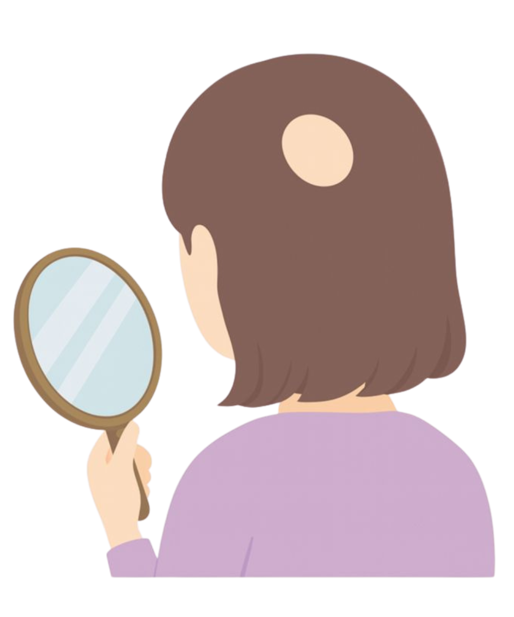 円形脱毛症に悩む女性のイラスト（スマホ用）