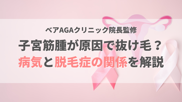 子宮筋腫が原因で抜け毛になる？貧血や女性ホルモンの乱れが起きやすい病気と女性の脱毛症の関係を解説