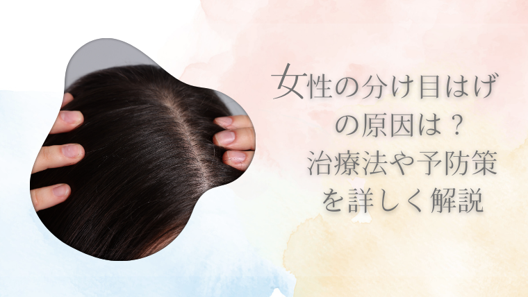 女性の分け目はげの原因は？治療法や予防策を詳しく解説