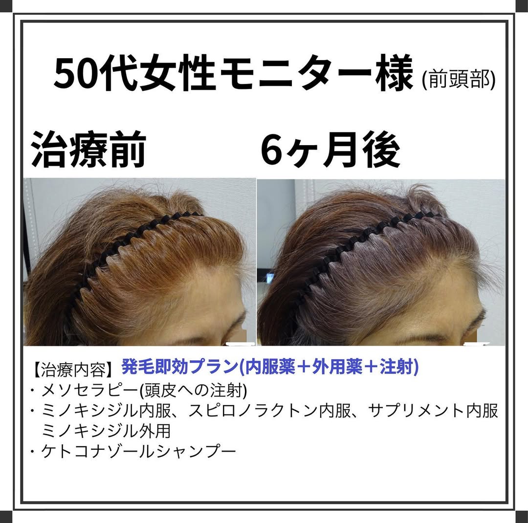 症例写真