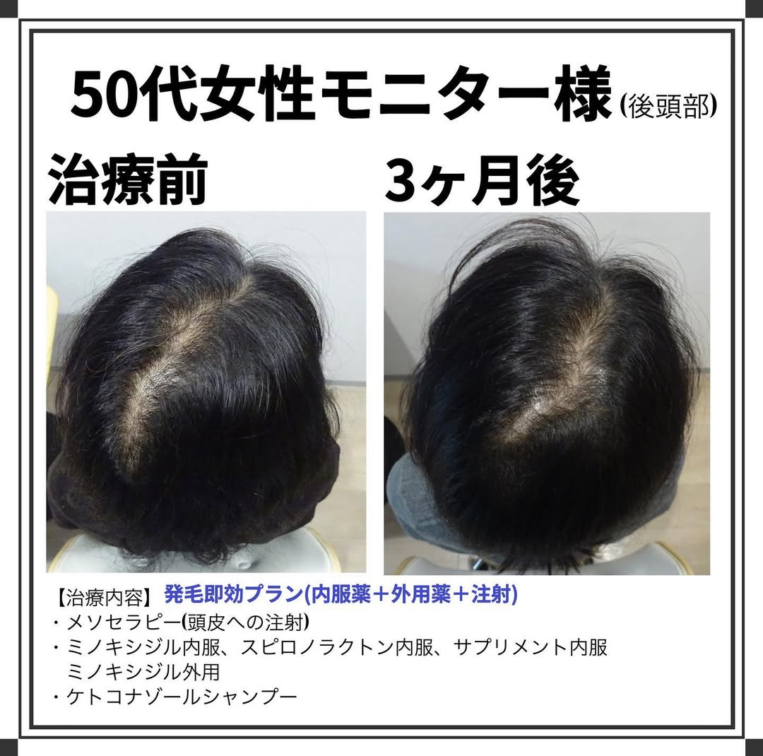 症例写真