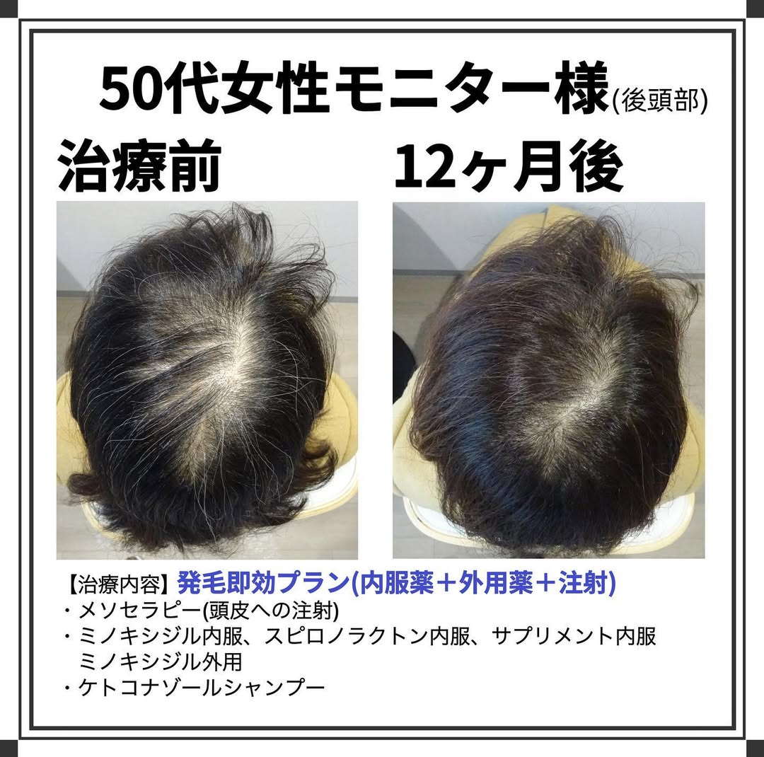 症例写真