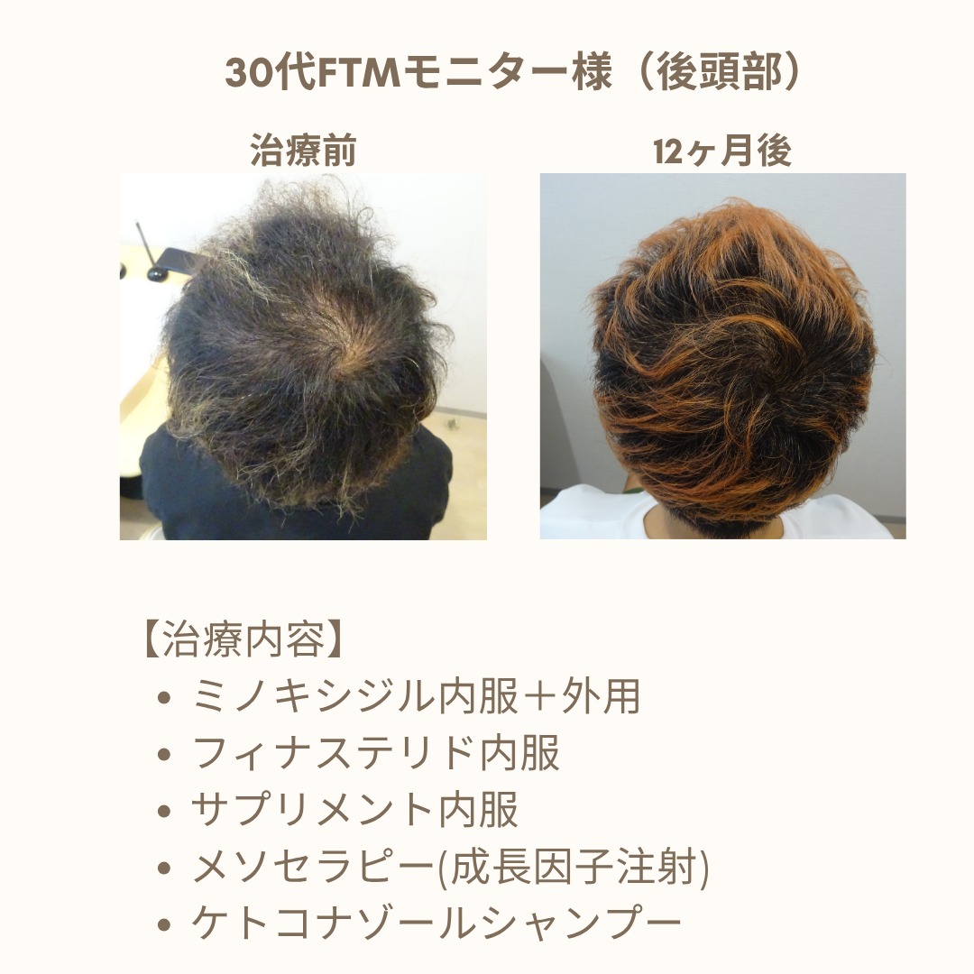 症例写真