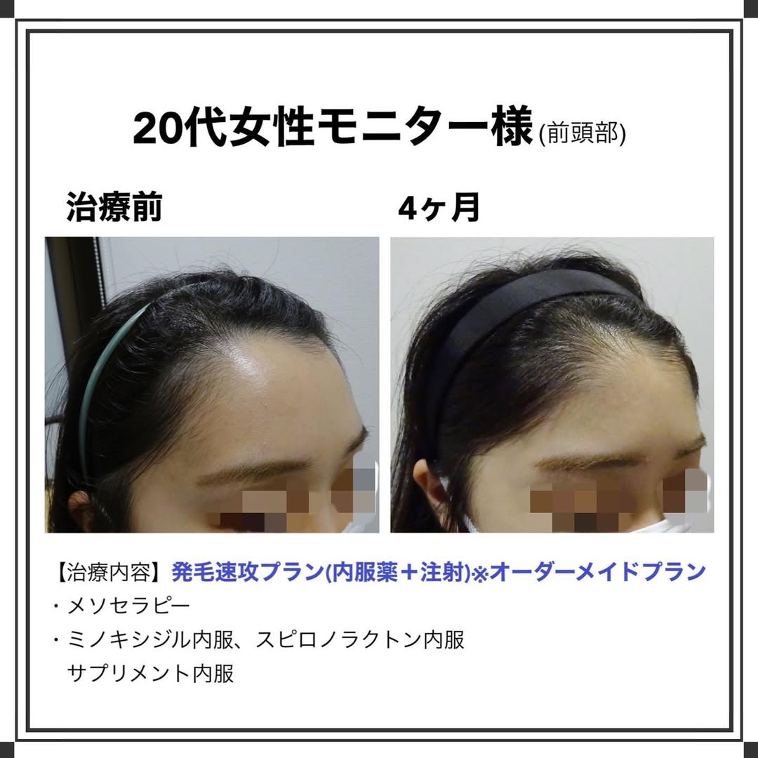 症例写真