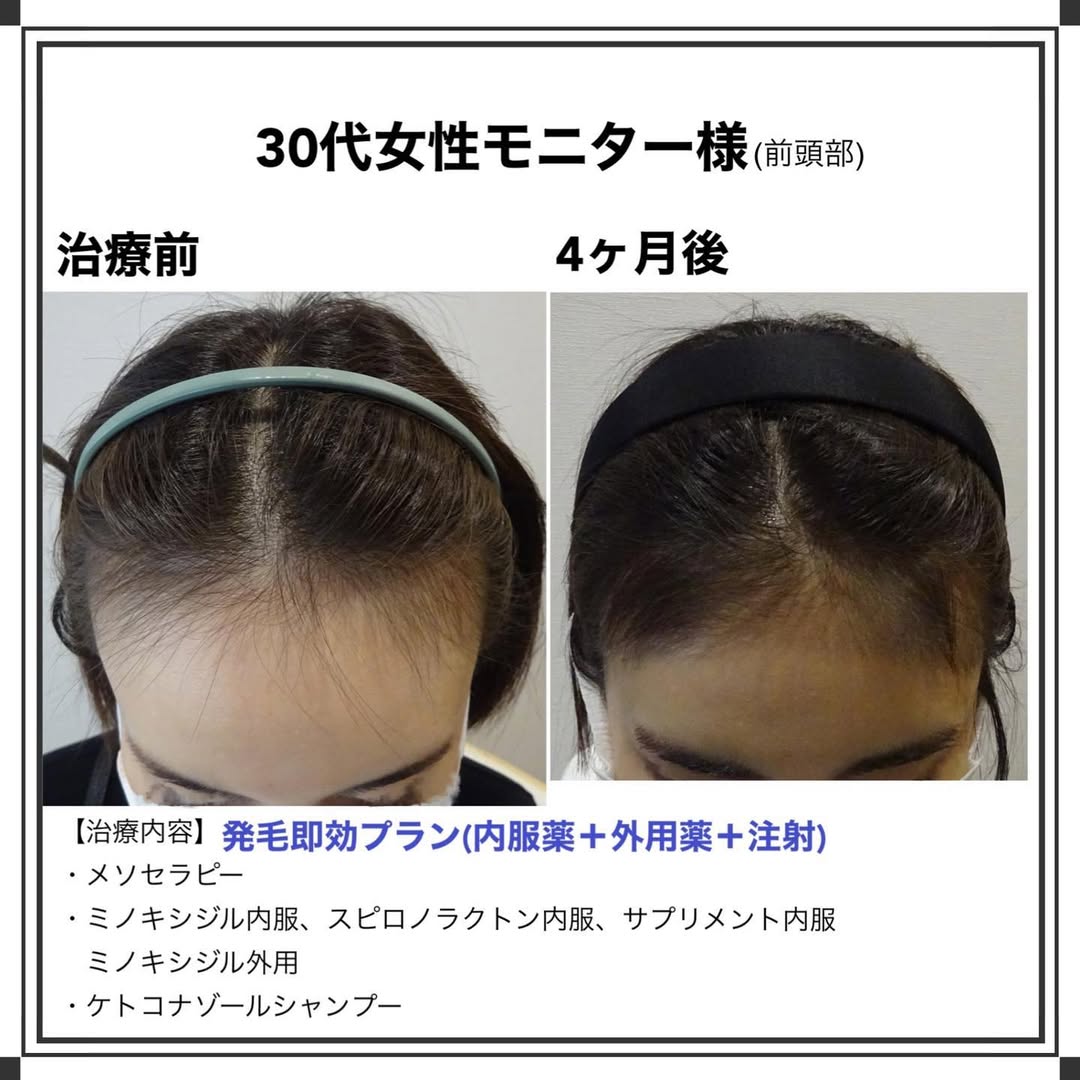 症例写真