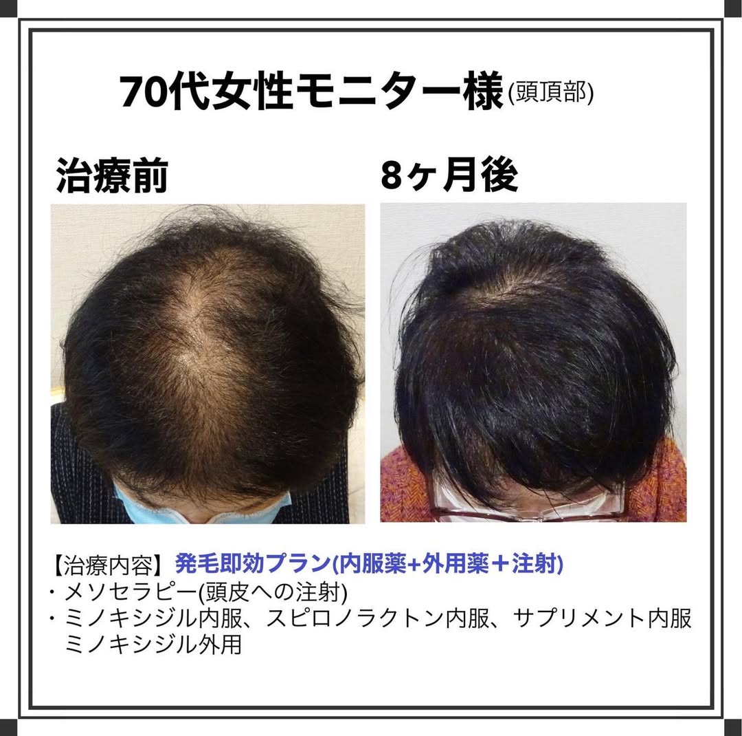 症例写真