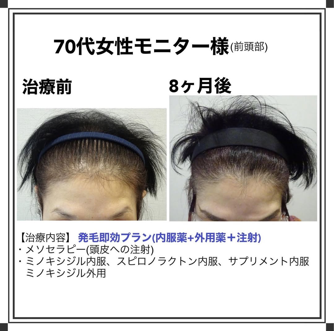 症例写真