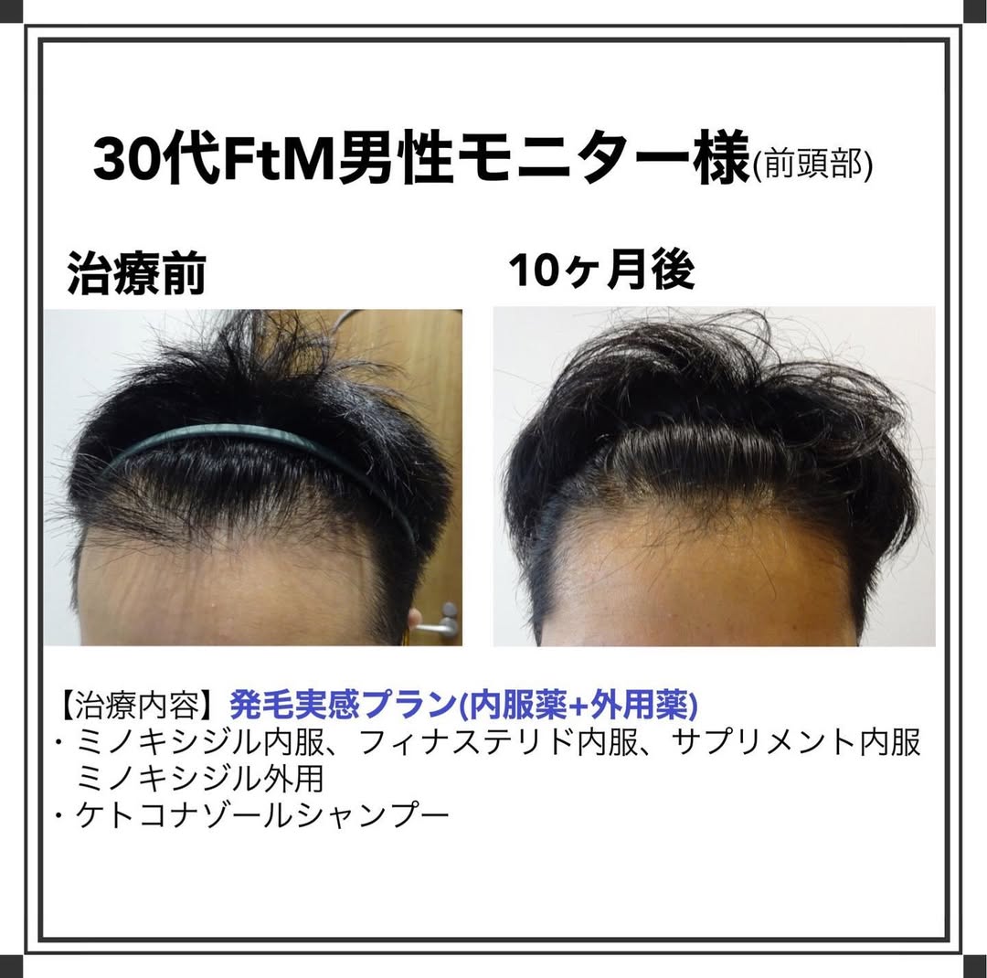 症例写真