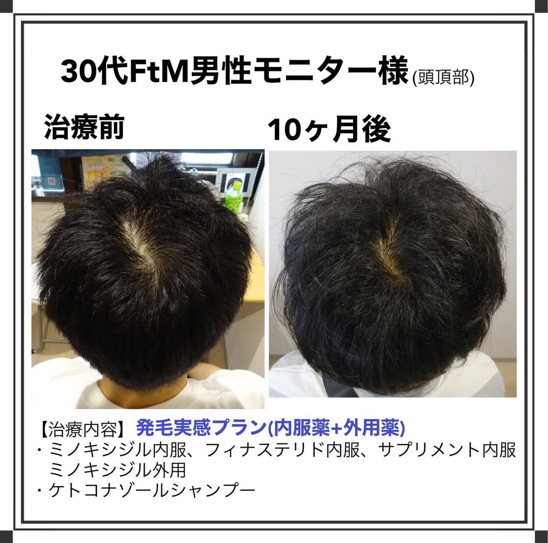 症例写真