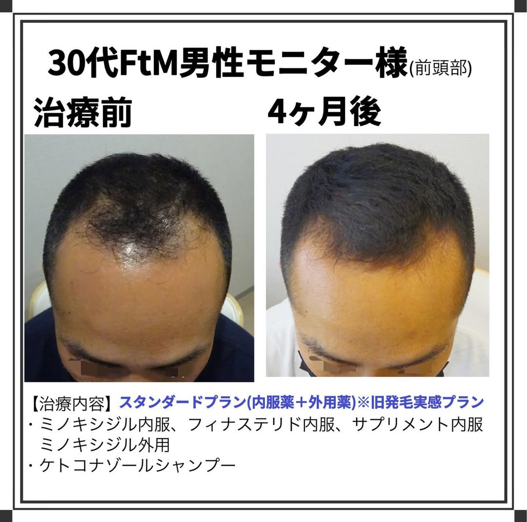 症例写真