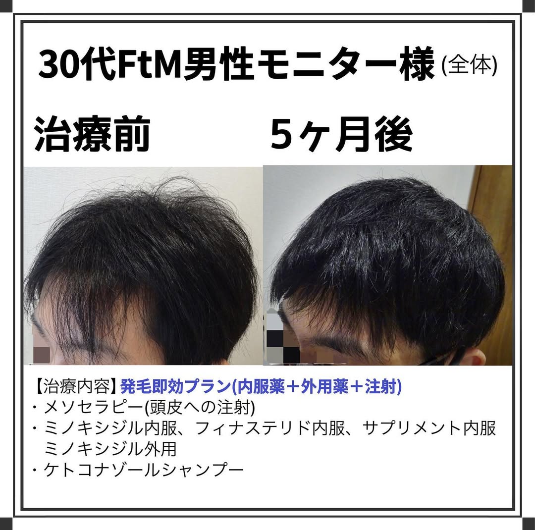 症例写真