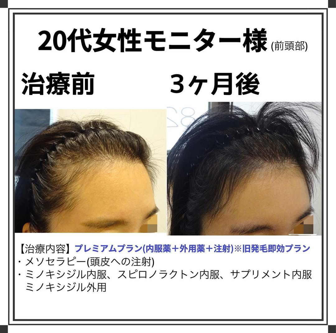 症例写真