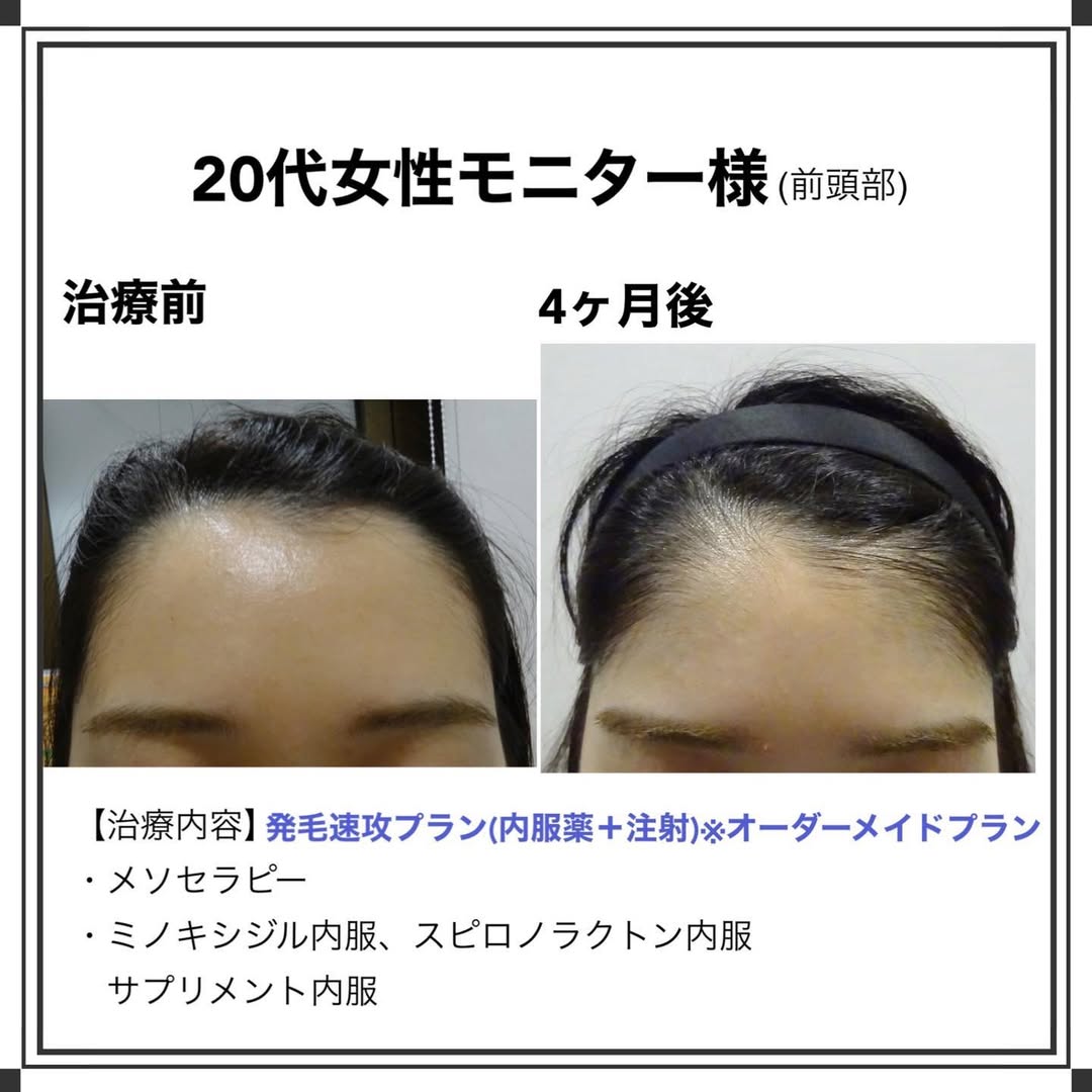 症例写真