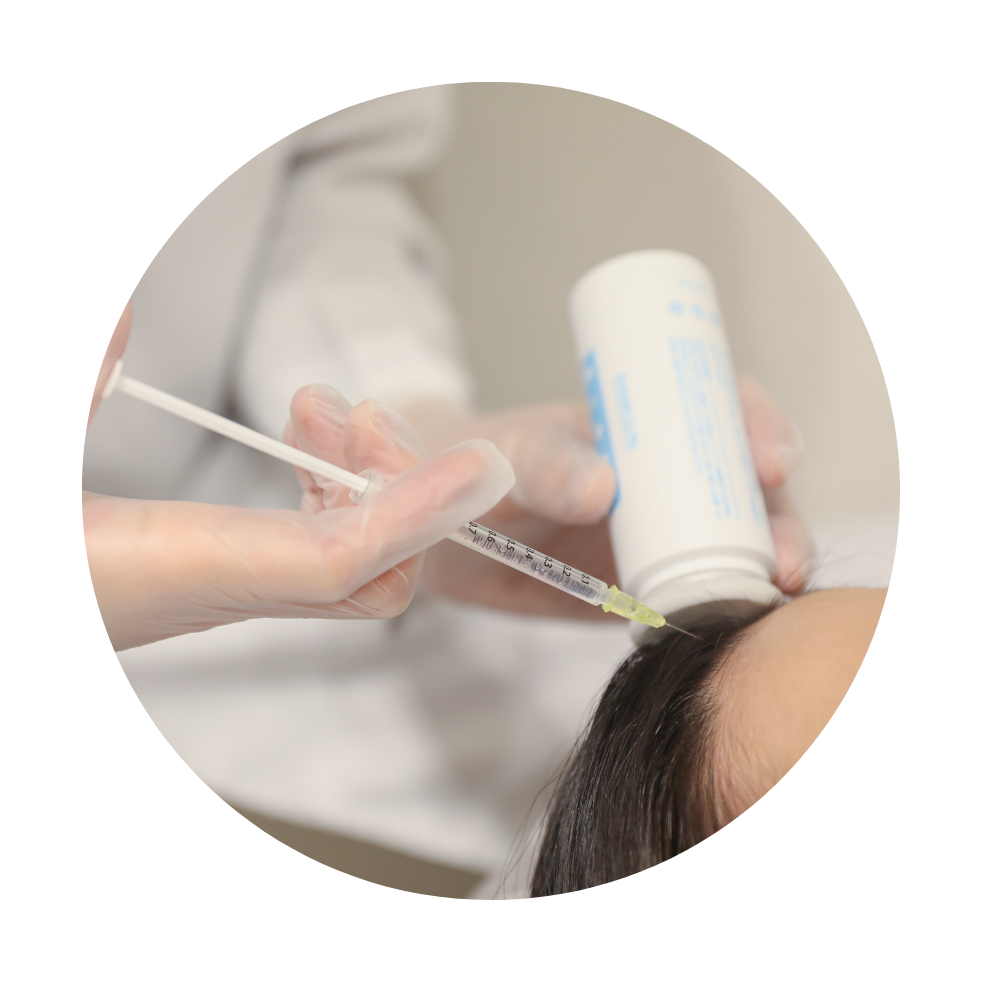 発毛プランより効果的な発毛メソセラピー女性