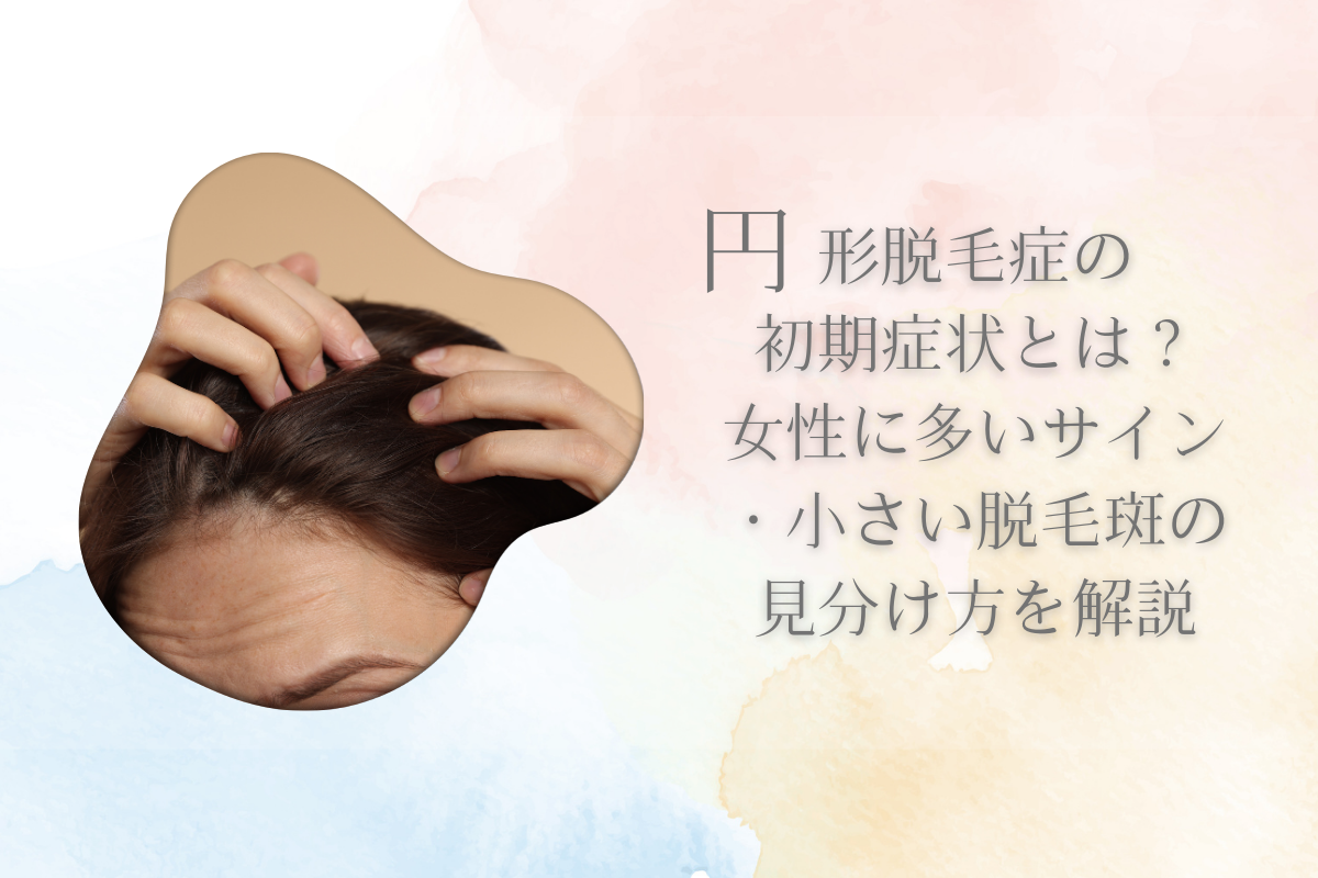 円形脱毛症の初期症状とは？女性に多いサイン・小さい脱毛斑の見分け方を解説